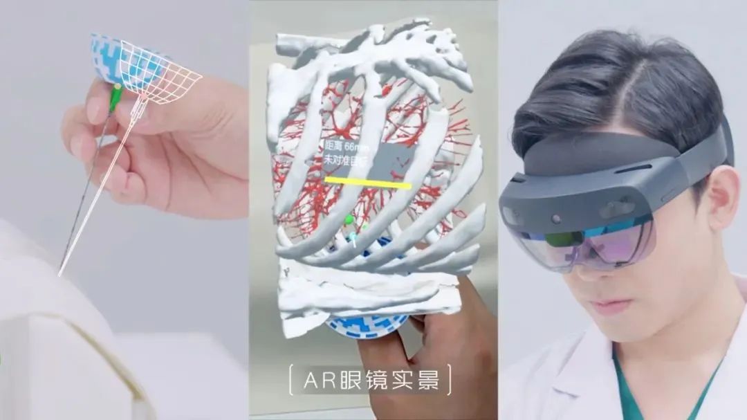 全球首创!复拓知达自研AI-AR导航设备获批,引领肺结节术中定位新时代 第2张 全球首创!复拓知达自研AI-AR导航设备获批,引领肺结节术中定位新时代 第2张